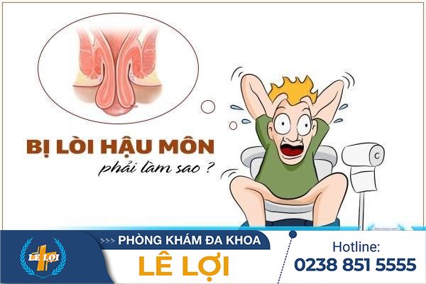 Bị lòi hậu môn phải làm sao?